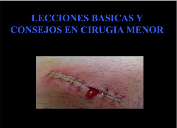 LECCIONES BASICAS Y CONSEJOS EN CIRUGIA MENOR